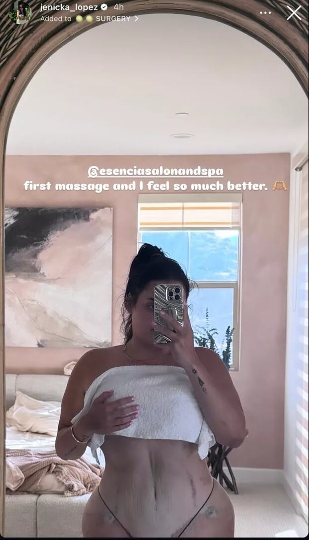 Esta fue la publicación que Jenicka López compartió en sus historias para que su público vea cómo está tras los procedimientos a los que se sometió (Foto: Jenicka López / Instagram)