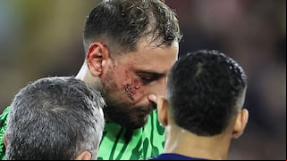 Tras los cortes en su rostro: ¿cuál es el primer diagnóstico de Donnarumma y el tiempo de baja?