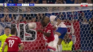 Tras salir con sangre en el rostro, ¿cómo jugará Mbappé sus próximos partidos en la Eurocopa?